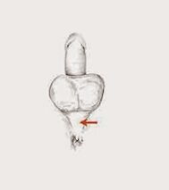 قوة العضلات وتوترها لزيادة فعاليتها